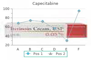 buy 500 mg capecitabine mastercard