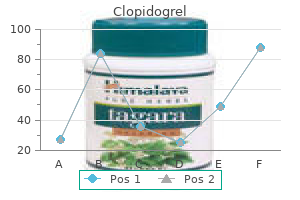 order clopidogrel 75 mg line