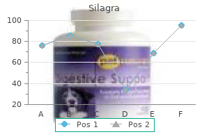 buy 50mg silagra visa