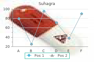 purchase suhagra 50 mg visa