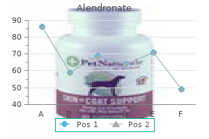 order 70mg alendronate visa