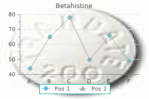 generic 16 mg betahistine fast delivery