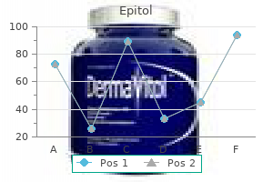 100 mg epitol fast delivery