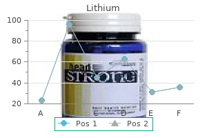 lithium 150 mg visa