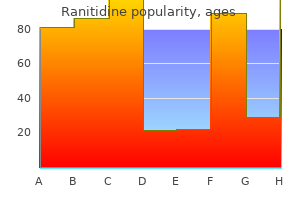 purchase ranitidine 300mg overnight delivery