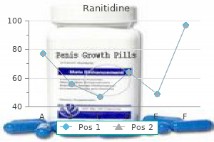 discount ranitidine online mastercard